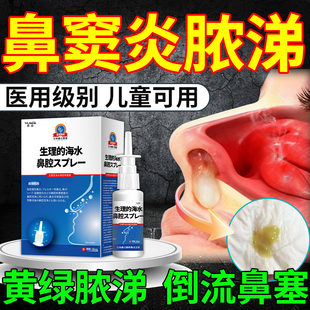 鼻窦炎排脓药监备案喷剂鼻炎喷雾剂非进口专根用的鼻涕倒流有痰KD
