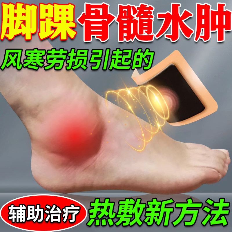 脚踝骨髓水肿脚腕疼痛膏药贴专用热敷韧带损扭伤滑膜炎关节积液KD