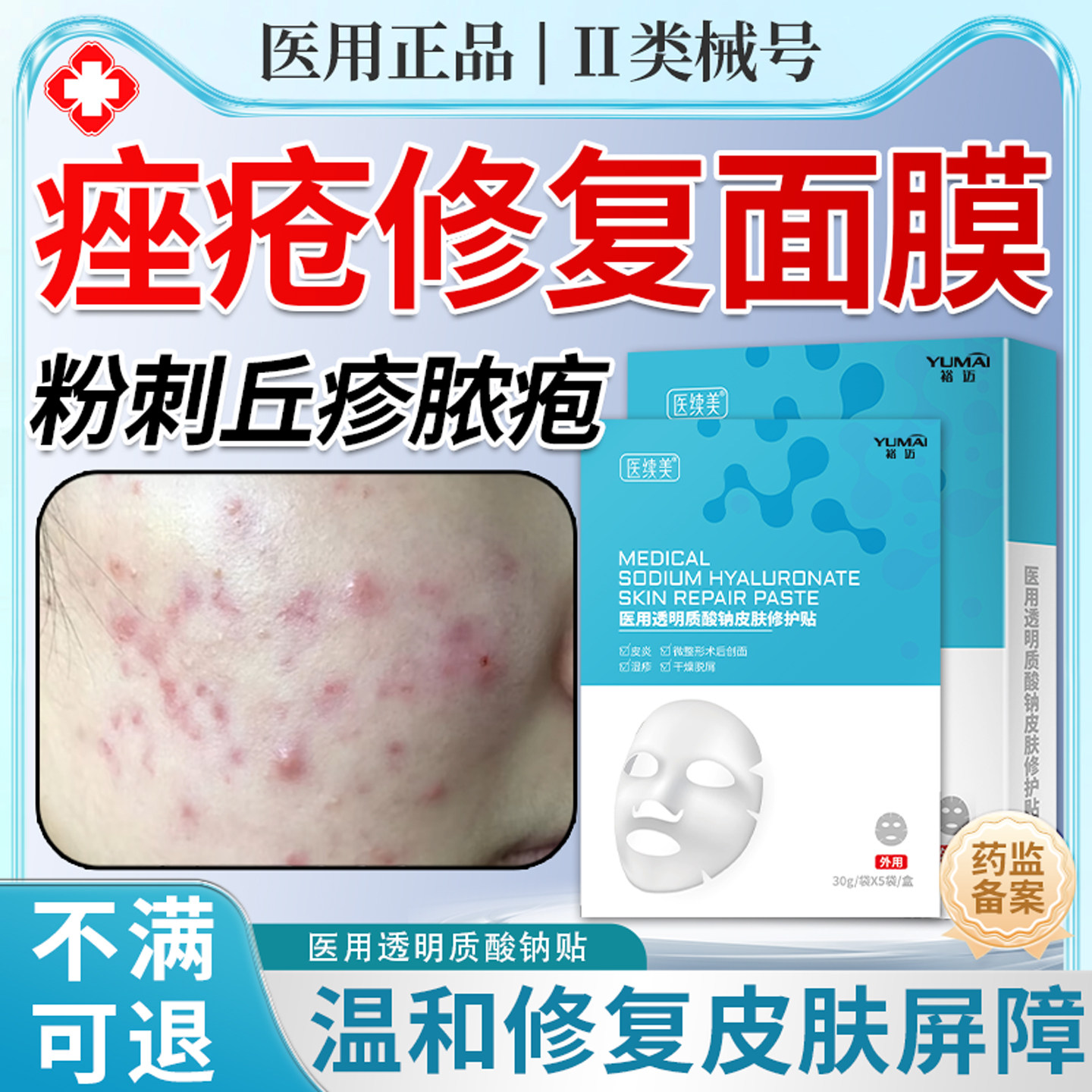 脸部痤疮医面膜用祛痘除玫瑰痤疮屏障痘痘修复消炎痘印毛囊炎KD