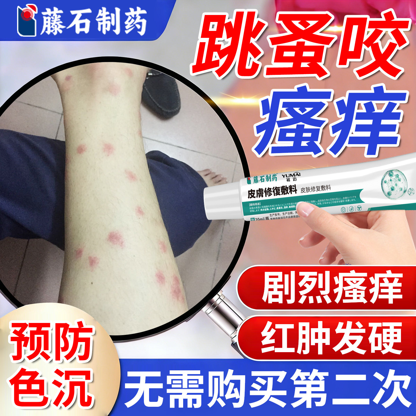 被跳蚤咬止痒膏瘙痒红肿专用咬了用什么搭膏药贴擦蚊虫叮咬消肿KD
