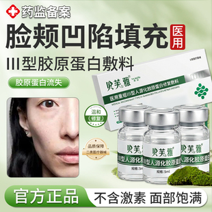 填充脸颊凹陷神器医用重组三型人源化胶原蛋白填充面部凹陷脸部KD