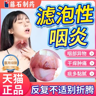 舌根咽后壁咽喉淋巴滤泡增生慢性咽炎咽喉炎除喷剂肿胀异物感根VV