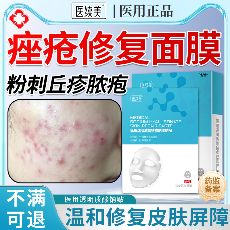 脸部痤疮医面膜用祛痘除玫瑰痤疮屏障痘痘修复消炎痘印毛囊炎KD