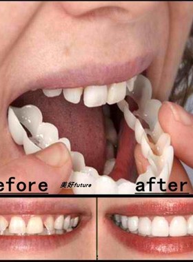 Snap On Tooth Flex Teeth Whitening Smile False Teeth Cover