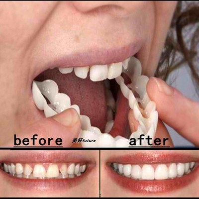Snap On Tooth Flex Teeth Whitening Smile False Teeth Cover
