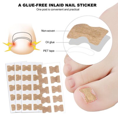 Ingrown Toenail Sticker Nail-Corrector Foot-Care Glue