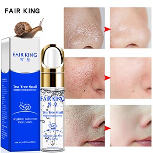 Face Serum Snail Hyaluronic Acid Essence tea tree Blemish