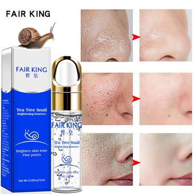 Face Serum Snail Hyaluronic Acid Essence tea tree Blemish
