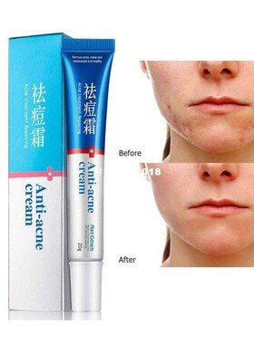 Comedone Pimple Anti Acne Treatment Acne Scar Blackhead Remo