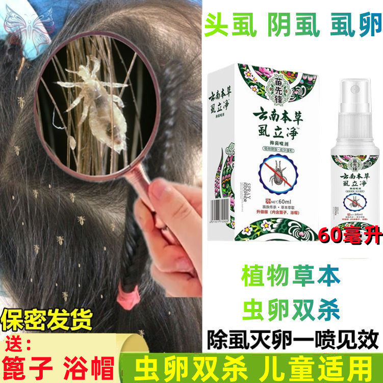 虱子药儿童头虱子大人用去除阴虱跳蚤小女孩头发虱卵一扫光洗发水