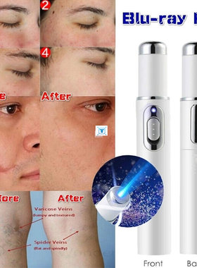 Portable Medical Blue Light Therapy Acne Laser Pen Skin Spot