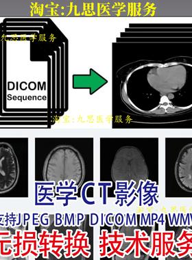 医学CT影像dicom格式文件转换任意格式文件 JPEG BMP PNG MP4 WMV