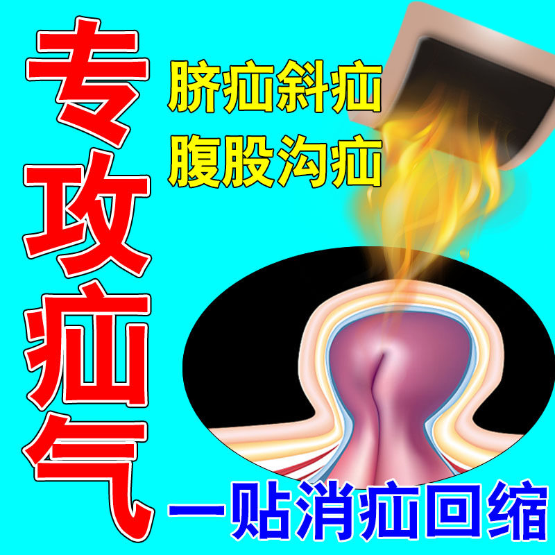 疝气贴腹股沟中老年治婴儿凸肚脐鼓包回缩直斜疝气小肠疝气消疝贴