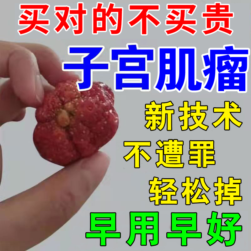 子宫肌瘤妇科炎症治疗卵巢囊肿瘤