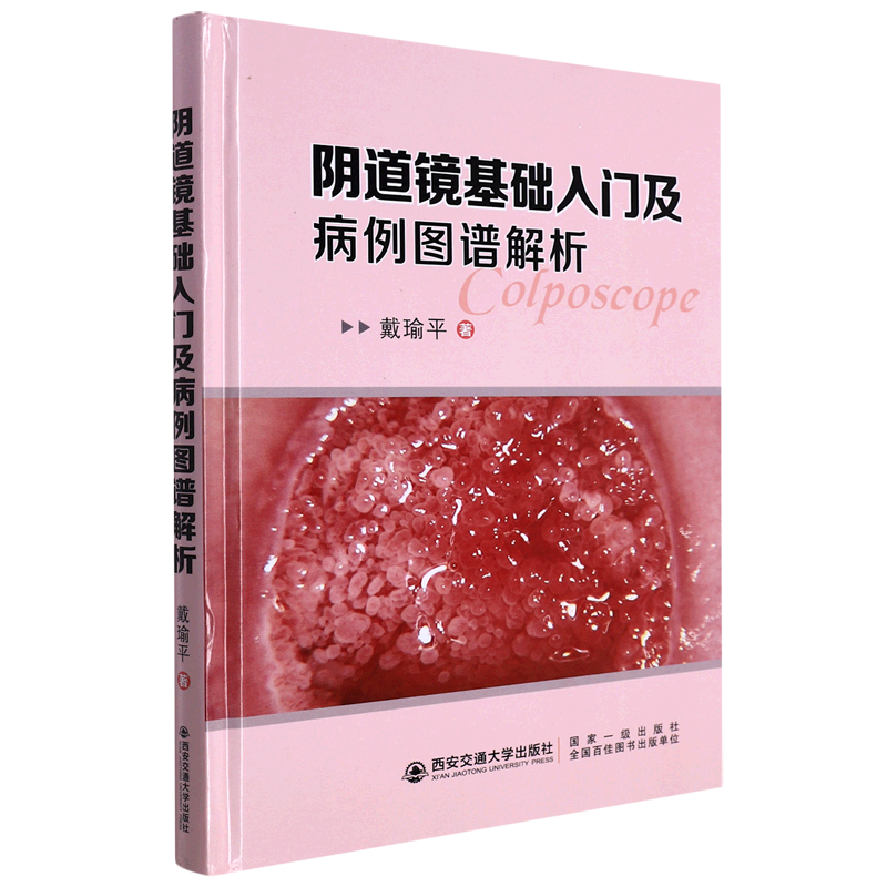 阴道镜基础入门级病例图谱解析