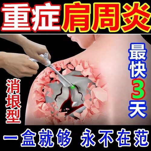 肩周炎贴膏护肩保暖旗舰店