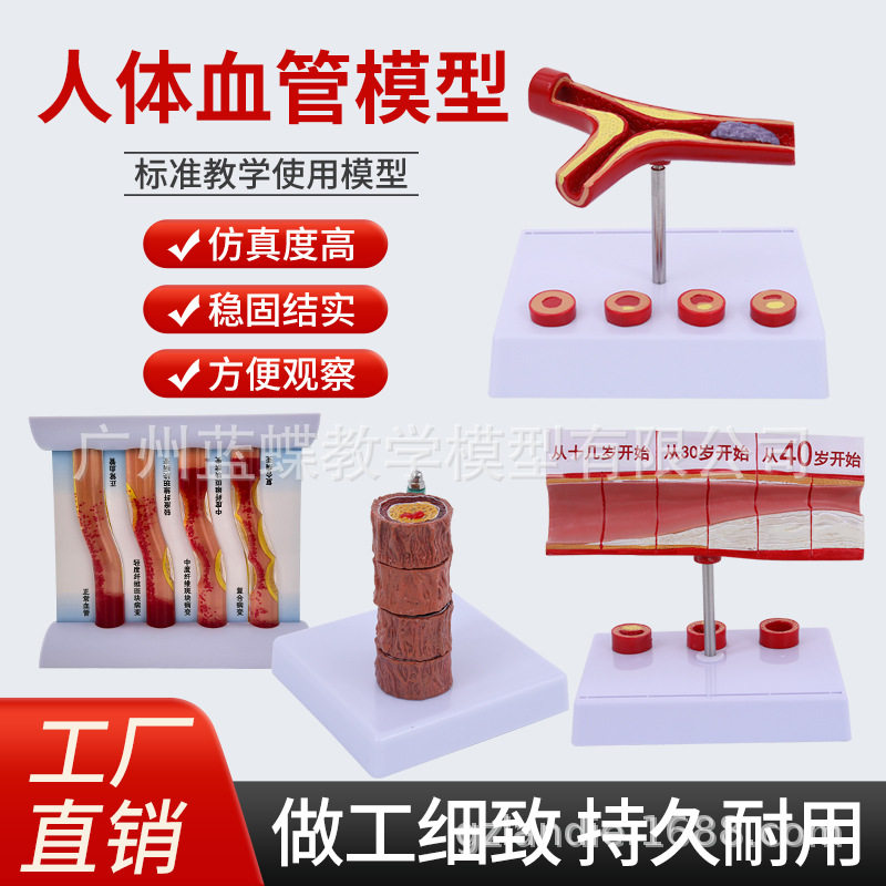 仿真人体冠状动脉性心血管动脉模型硬化模型老年心脏模型血栓模型