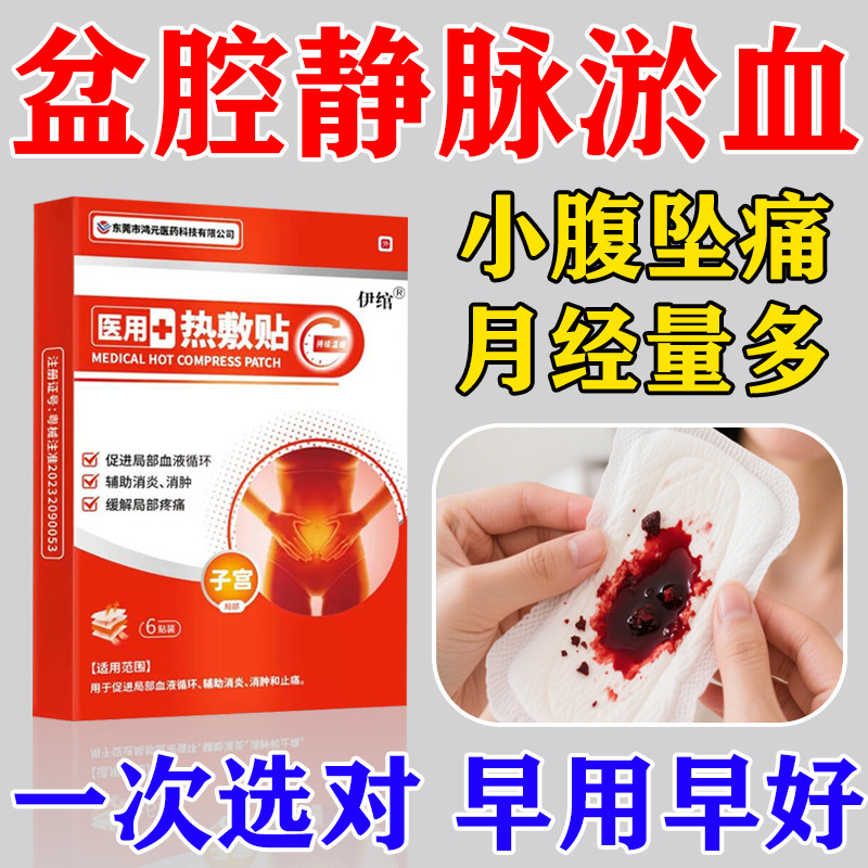 盆腔静脉淤血综合征热敷贴