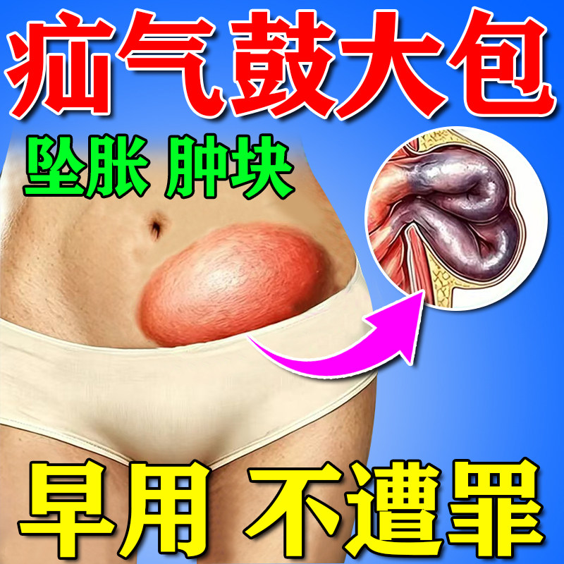 【疝气清喷剂】腹股沟疝脐疝斜疝
