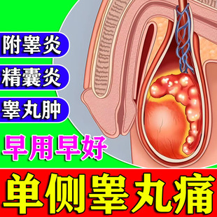 附睾炎阴囊硬块结节附睾头囊肿疼痛硬结睾丸炎精索静脉曲张膏药贴