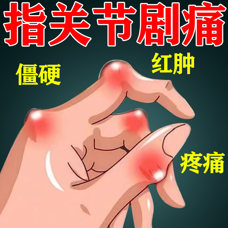 【指关节剧痛】手指关节骨性关节炎辰僵疼痛指关节肿大活动受限用