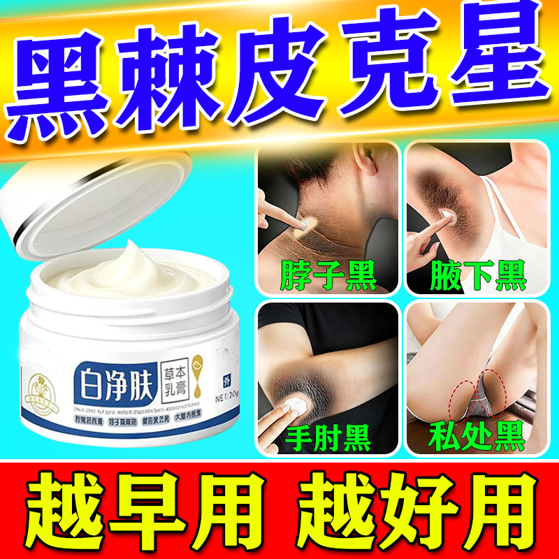 【黑棘皮】胳膊肘去黑皮肤黑色素沉淀去除大腿内侧私处美白粉嫩膏
