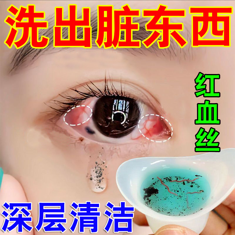 医用洗眼液清洁抗菌消焱眼睛干痒有螨虫洗眼睛水眼部护理液神器Z