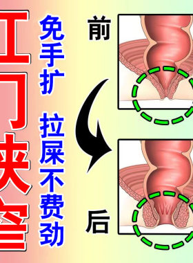 肛门狭窄便秘有肉球痒脱肛裂肛门闭锁大便变细拉不干净有异物感Z