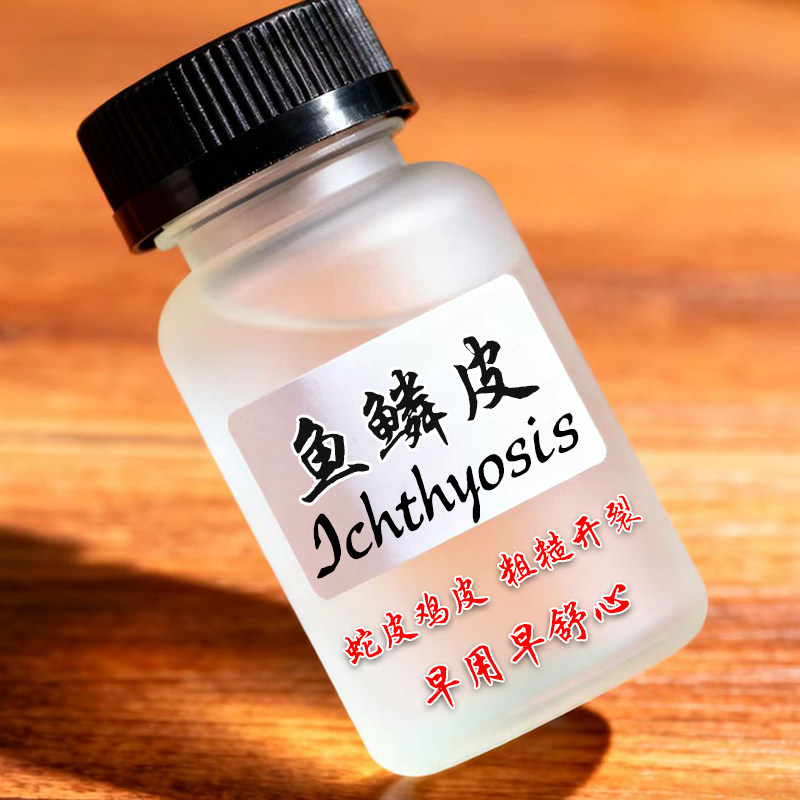 鱼鳞病皮肤霜用专药蛇皮肤身体乳小腿干燥起皮毛囊角化克星效特药