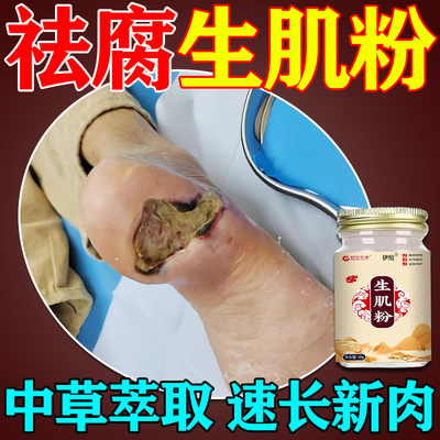 【伤口愈合粉促进伤口愈合长肉】