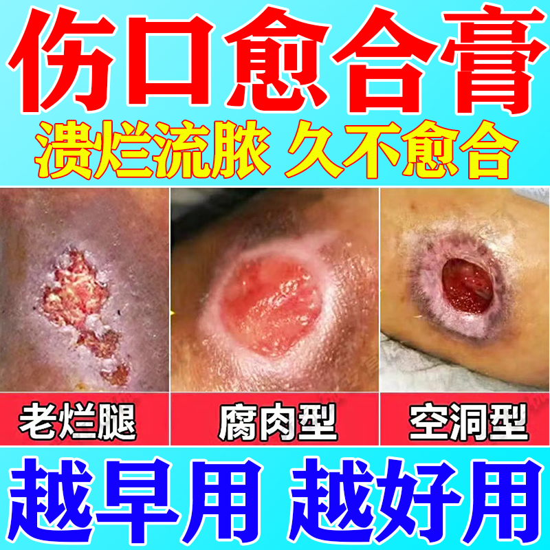 去腐生肌】伤口愈合促进长肉治疗伤口消炎杀菌修复糖尿病足脉管炎