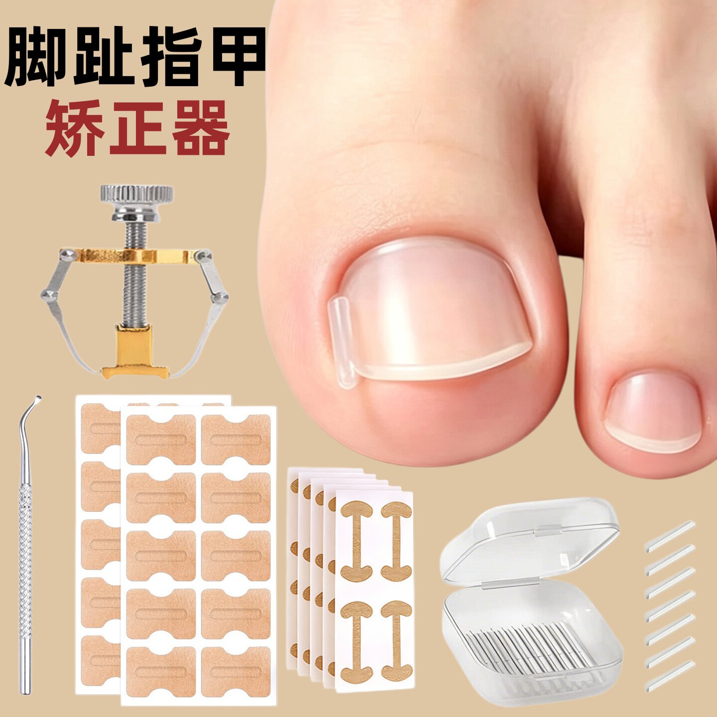 甲沟矫正器正甲贴片神器指甲纠正器隔离填充垫脚趾甲往肉里长专用