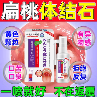 口臭扁桃体结石去除工具漱口水清理隐窝冲洗器口腔异物感专用喷剂