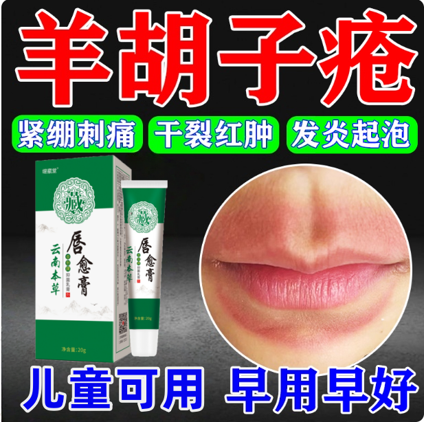 羊胡子疮成人儿童嘴巴一圈红肿上火周口唇焱孩子舔嘴唇干裂专用膏