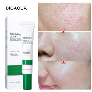 20G Salicylic Acid Acne Removal Cream Shrink Pores Refining