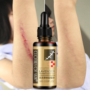 Pregnant woman stretch Remove Lavender Scars marks oils Acne
