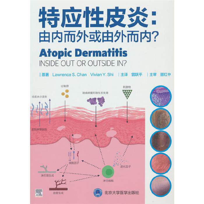 【正版】特应性皮炎:由内而外或由外而内?曾跃平