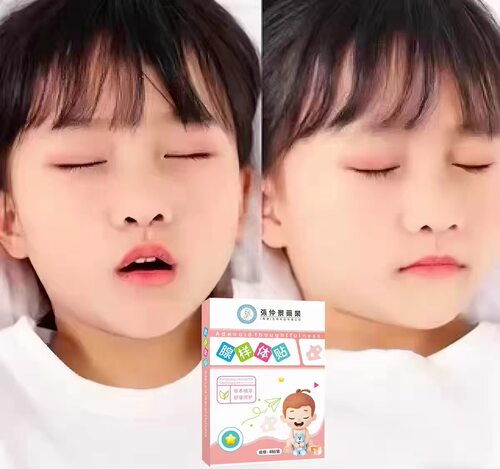 【张仲景】儿童腺样体贴