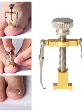Nail-Recover-Tool Pedicure Ingrown Toenail Foot-Care Nail-Na