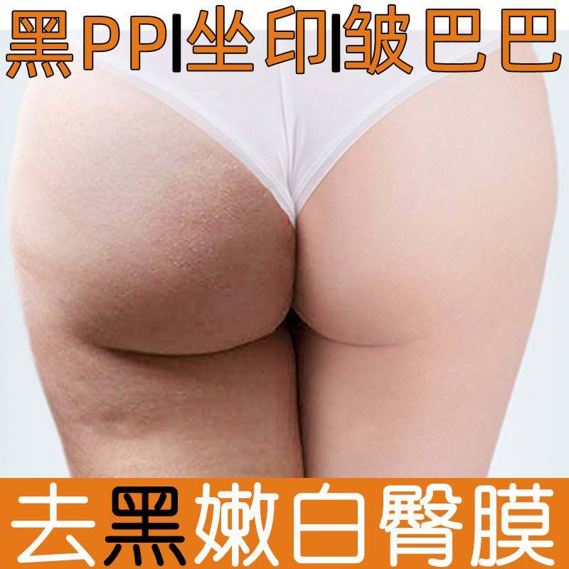 臀膜美臀面膜屁屁臀部护理保养去黑色素坐印屁股私密嫩白提亮紧致