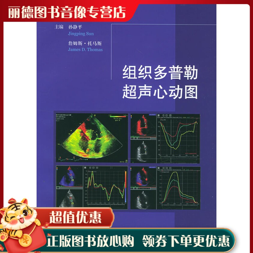 组织多普勒超声心动图