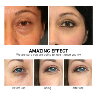 Retinol Hyaluronic Acid VC Eye Mask Eye Patches Repair Eye