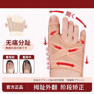 德国品牌拇指外翻小趾内翻脚趾矫正器脚趾头分离纠正分趾器大脚骨