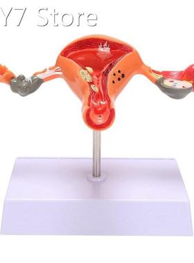 Uterus Model Ovary Model Anatomy Female Reproductive Organ M