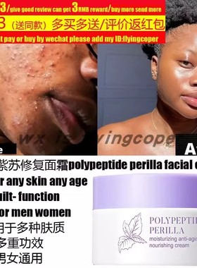 Turmeric Face Whitening Cream Dark Skin Acne spots african霜