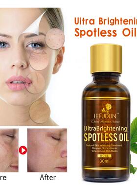 Rose plant essential oil revitalizes, brightens, moisturize