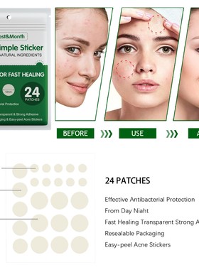 Acne Pimple Patch Stickers Treatment Pimple Remover