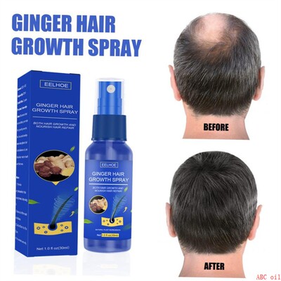 EELHOEGinger Hair Growth Serum Spray Anti Hair Loss Regrowth