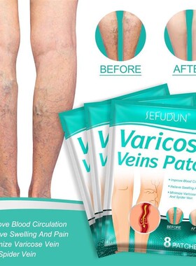 Varicose Veins Patch Spider Veins Veins Pain Relief Patch