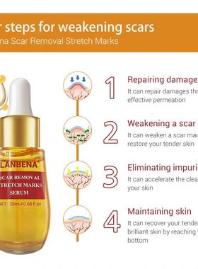 LANBENA 蓝蓓娜SCAR REMOVAL STRETCH MARKS SERUM